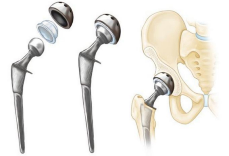 6ec466d6f99b4e20bf20f20674fd38ab