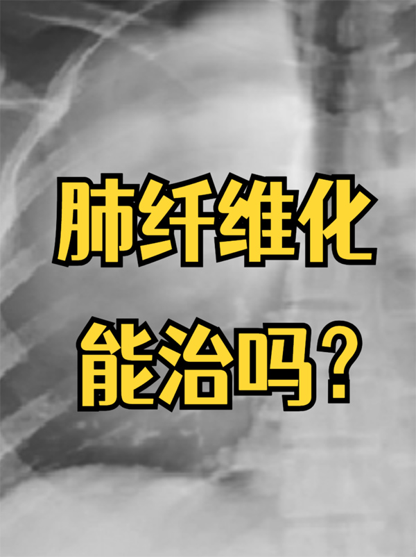af0653dcc72d563252a4e6dc86cdd7be