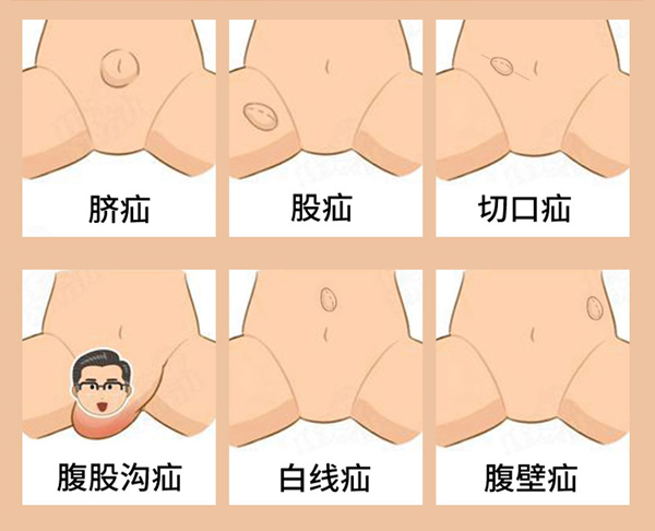 20220319152156635 - 副本